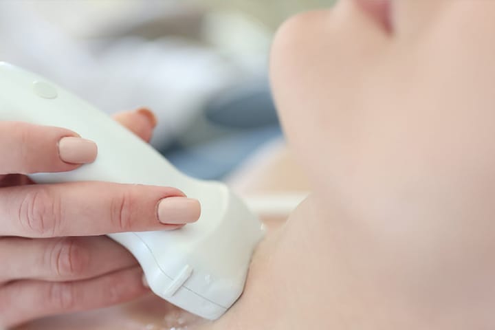 頸動脈のエコー検査の様子